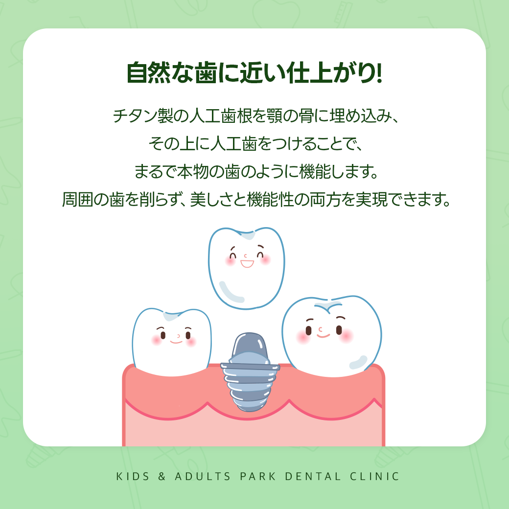 インプラントおすすめ