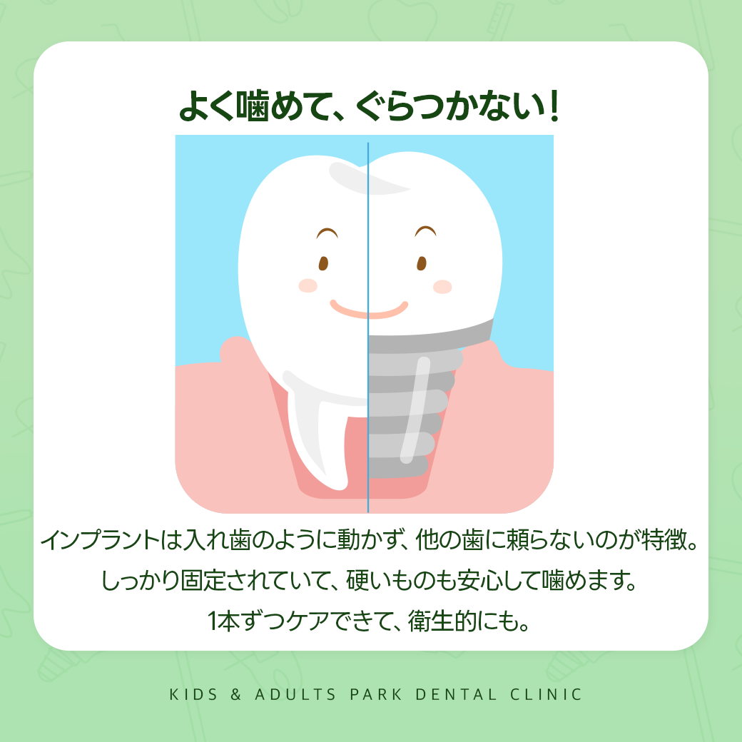 インプラント治療