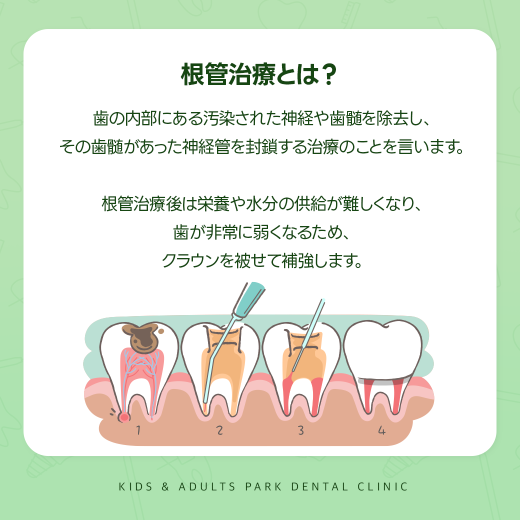 西淀川区根管治療